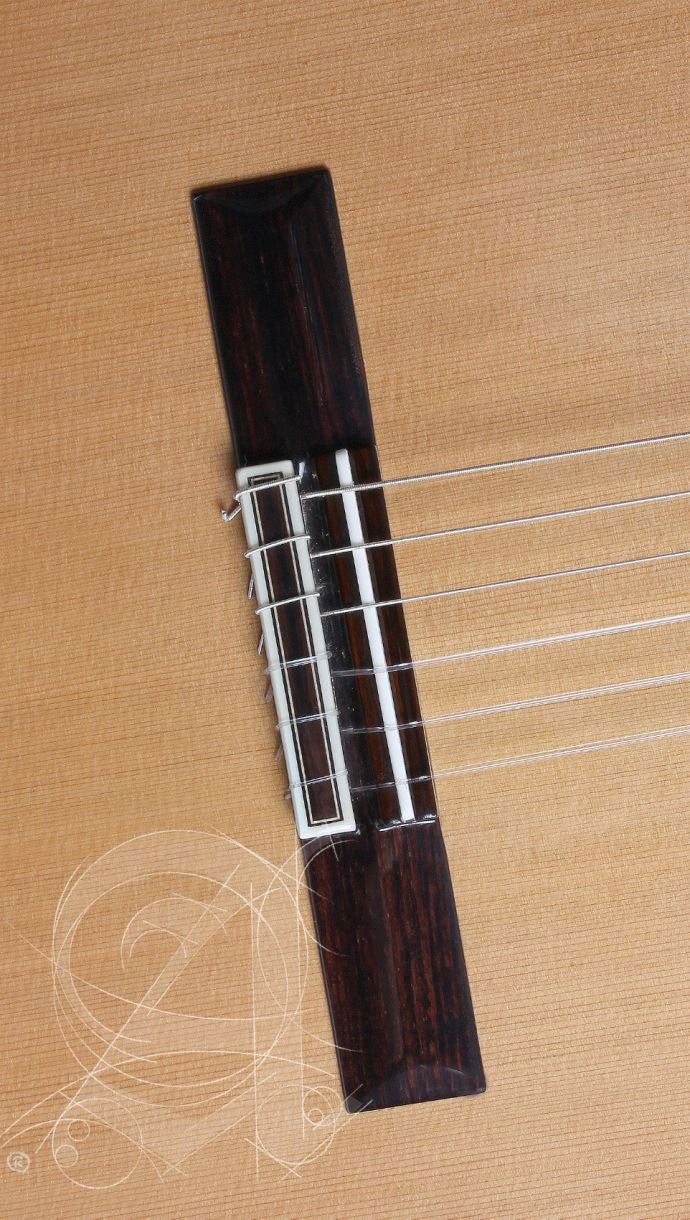 Concert 10 Premier + 9557 Case